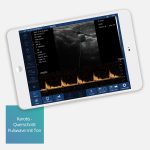 KONVEKSNA BEŽIČNA SONDA C3cs myMides - Slika 5