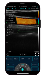 myMIDES C10 ultrazvučna sonda s dvije glave - Slika 4